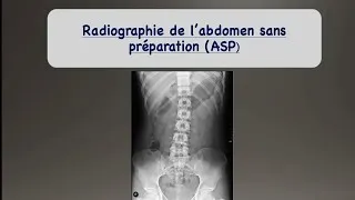 Miniature : Radiologie - 1er cours : ASP (1ère partie)