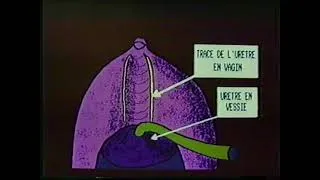 Miniature : URETRE EN VESSIE ET EN VAGIN