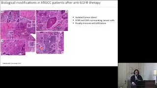 Miniature : Sandra Schmitz : Impact of the tumor environment on treatment resistance in head and neck cancer