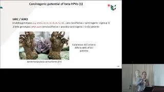 Miniature : Michael Herfs: La carcinogenèse liée au papillomavirus humain