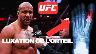 Miniature : Ciryl Gane : sa blessure choc à l’UFC 310 expliquée