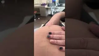 Miniature : Rendez-vous des 30 semaines de grossesse