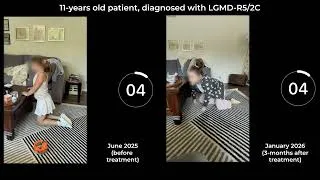Miniature : Changing the Path of LGMD-R5