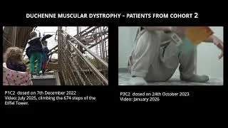 Miniature : Duchenne Muscular Dystrophy: Gene Therapy Brings New Hope