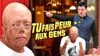 Miniature : Se Moquer d’une Personne BRÛLÉE ( Expérience Sociale ) - AKHMETOV