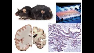 Miniature : Thérapie des cancers (ENS L3)