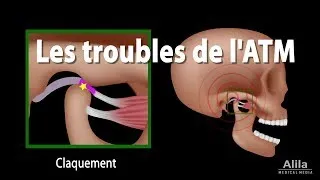 Miniature : L'ATM est le Déplacement du Disque, Animation