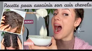 Miniature : SOIN PURIFIANT pour LE CUIR CHEVELU