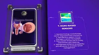 Miniature : Nanotechnology for Prostate Cancer Therapy