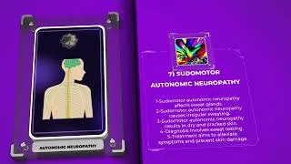 Miniature : Autonomic Neuropathy