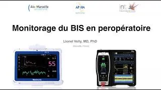 Miniature : Monitorage du BIS en peropératoire Webinar ANARLF JEUNES - L.Velly