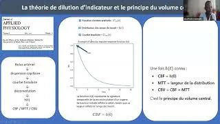 Miniature : Imagerie de perfusion par ultrasons au chevet des patients cérébrolésés - Pr C. Gakuba
