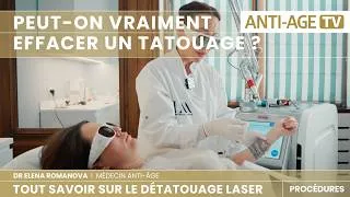 Miniature : Peut-on vraiment effacer un tatouage ? Démonstration complète au laser picoseconde.