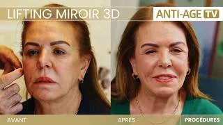 Miniature : Lifting cervico-facial : comprendre les indications et les principes chirurgicaux