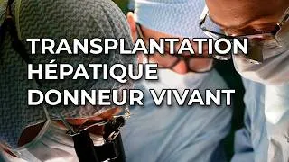 Miniature : Transplantation hépatique donneur vivant