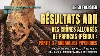 Miniature : Résultats des crânes allongés de Paracas au Pérou, Partie 3 : Anomalies physiques