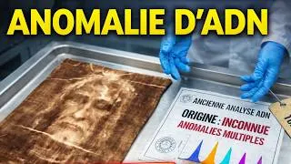 Miniature : 76 LADN trouvé sur le suaire de Turin oblige les scientifiques à tout reconsidérer