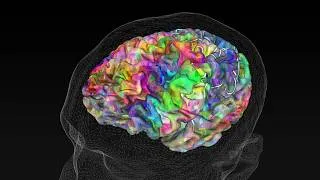 Miniature : la maladie d'alzheimer