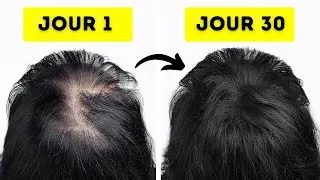 Miniature : En 30 Jours : De Chute À Cheveux Incroyables ! 10 Astuces Naturelles Incroyables !