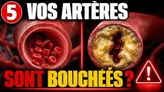 Miniature : 5 signes que vos arteres sont bouchees (avant qu'il ne soit trop tard)