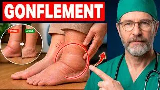 Miniature : Un chirurgien révèle : CE geste simple élimine les jambes et chevilles gonflées ! | Santé Senior