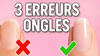 Miniature : 👉 3 erreurs à éviter pour garder de beaux ongles 💅