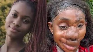 Miniature : Grâce au réseaux sociaux cette fille va finalement retrouver le sourire.