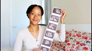 Miniature : ♡Bébé no.2 et guérison♡