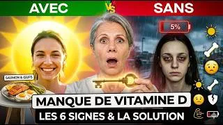 Miniature : 6 Signes de Carence en Vitamine D : Votre corps vous envoie ces messages !