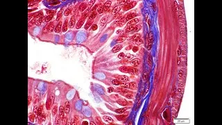 Miniature : Histologie (introduction)!! فيديو جديد!!!