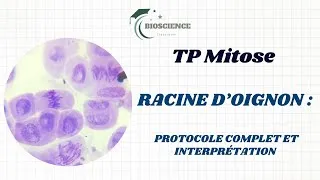 Miniature : TP Mitose – Racine d'oignon : observation des phases | Biologie cellulaire L1