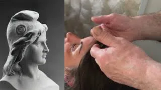 Miniature : Endométriose : troublante découverte sur l'origine et perspectives de guérison?