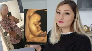Miniature : Le 1er trimestre de grossesse l symptômes, annonces...