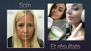 Miniature : Avoir une peau saine avec la gamme skin nutrition.