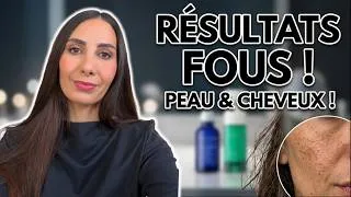 Miniature : ♥️ Taches, Collagène, Cheveux : les soins à retenir !