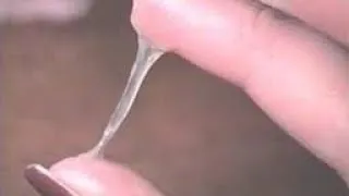 Miniature : Fertilisé les spermatozoïdes naturel remède