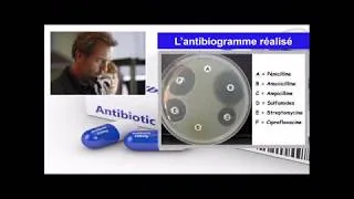 Miniature : Les antibiotiques c'est pas automatique :