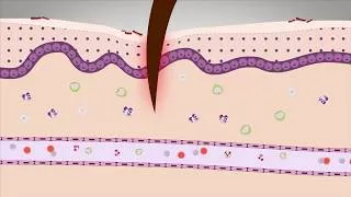 Miniature : La réaction inflammatoire CANOPE