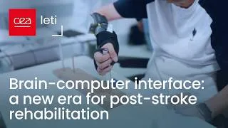 Miniature : Brain-Computer Interface: A New Era for Post-Stroke Rehabilitation