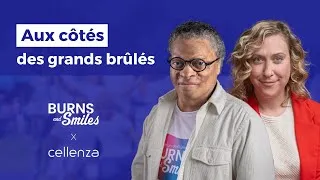 Miniature : Burns and Smiles x Cellenza : Engagés pour la reconstruction des grands brûlés