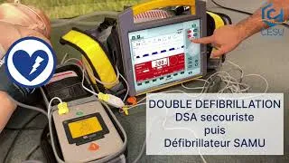 Miniature : Double défibrillation séquentielle pour la fibrillation ventriculaire réfractaire