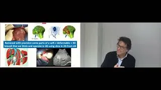Miniature : La réalité aumentée en chirurgie du foie - Eric Vibert