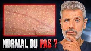 Miniature : Si Vous Avez Ça Sur Le 🍆 : Regardez Cette Vidéo !
