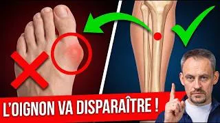 Miniature : LA BOSSE SUR L’ORTEIL DISPARAÎTRA POUR TOUJOURS ! Rééquilibrer les muscles du pied