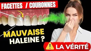 Miniature : LES FACETTES PUENT ! UNE BOUCHE ODEUR CACA ?😷💩