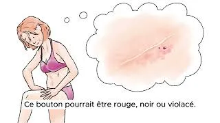 Miniature : Mélanome – Quel suivi pour éviter une éventuelle récidive ?
