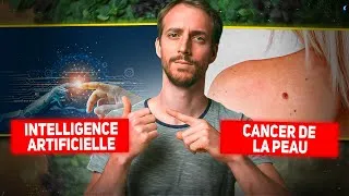Miniature : L'intelligence artificielle pour détecter des cancers de la peau