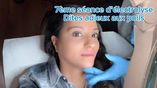 Miniature : Comment faire disparaître les poils du visage définitivement ? L’électrolyse est la solution 🔥