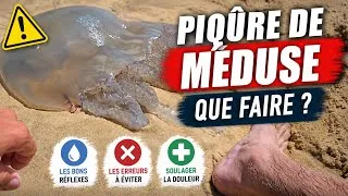 Miniature : Comment soigner une piqûre de méduse ?