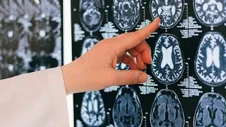 Miniature : Ton cerveau se modifie au fil de ton cycle (preuve scientifique)